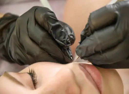 Therapist conducting electrolysis on clients upper lip